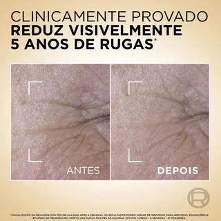 Sérum Facial Age Perfect Le Duo Rejuvenescedor L’Oréal Paris